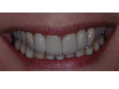 After - Brunswick Dental Practice