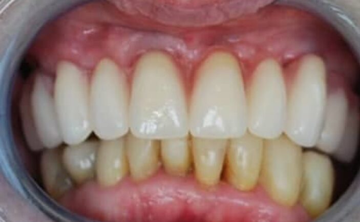 After - Brunswick Dental Practice