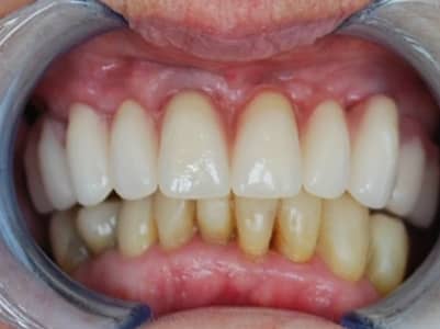 After - Brunswick Dental Practice