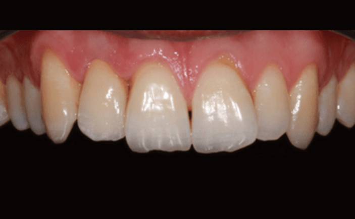 After - Brunswick Dental Practice