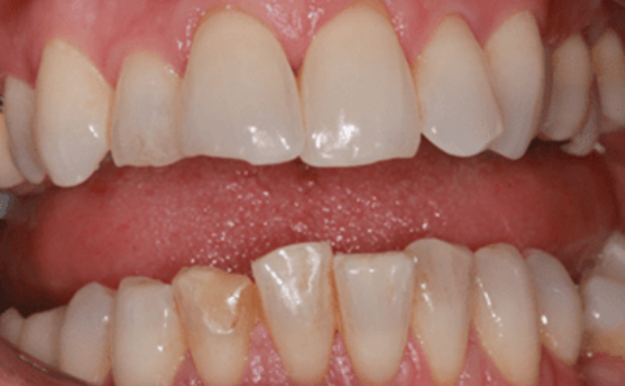 Before - Brunswick Dental Practice