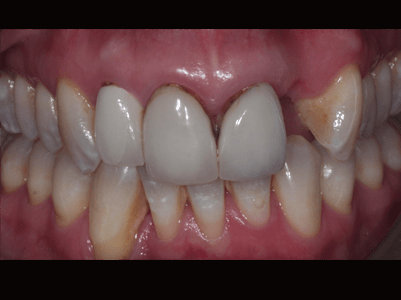 Before - Brunswick Dental Practice