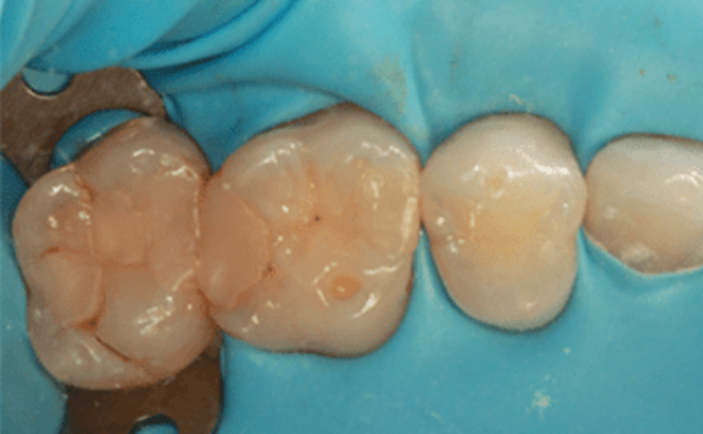 Before - Brunswick Dental Practice