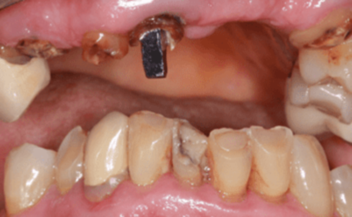 Before - Brunswick Dental Practice