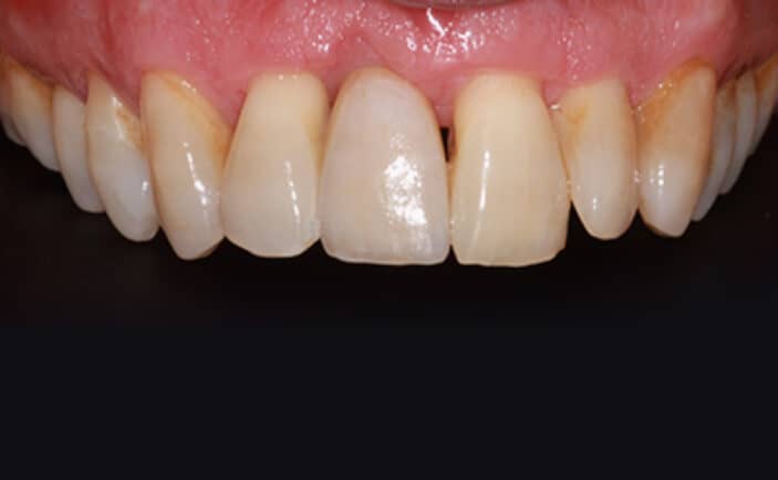 After - Brunswick Dental Practice