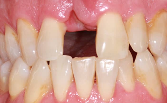 Before - Brunswick Dental Practice