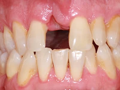 Before - Brunswick Dental Practice