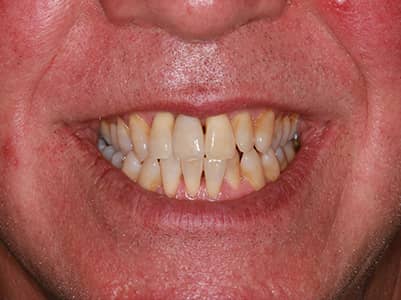 After - Brunswick Dental Practice