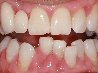 Before - Brunswick Dental Practice