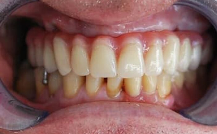 After - Brunswick Dental Practice