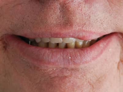 After - Brunswick Dental Practice