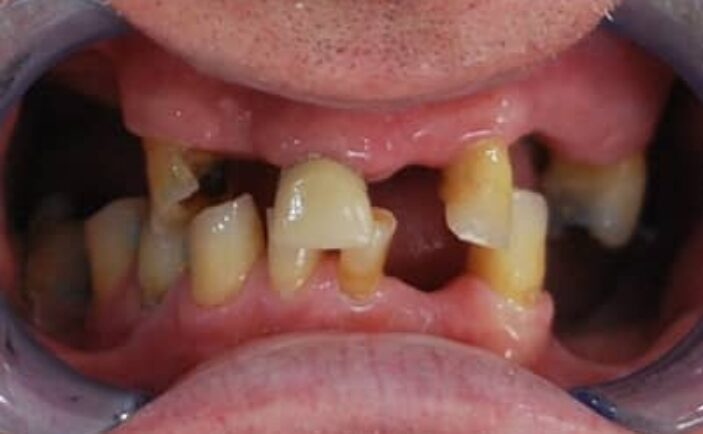 Before - Brunswick Dental Practice