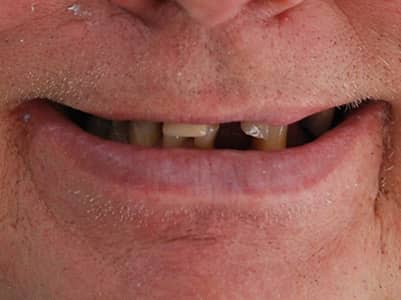 Before Face - Brunswick Dental Practice