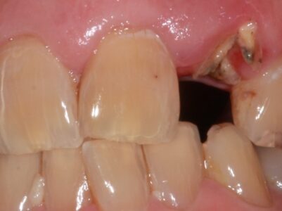 Before - Brunswick Dental Practice