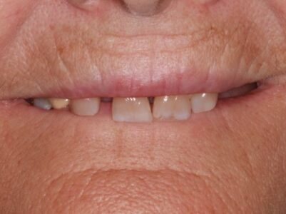 Before - Brunswick Dental Practice