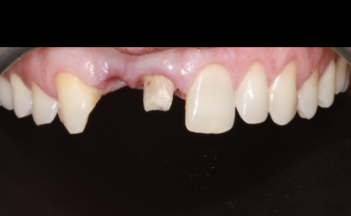 Before - Brunswick Dental Practice