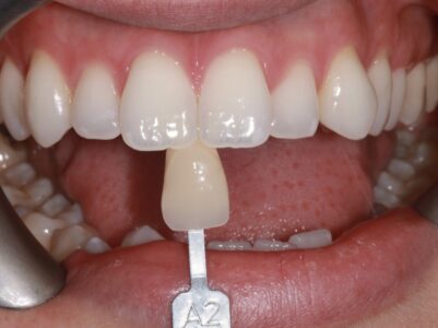 After - Brunswick Dental Practice