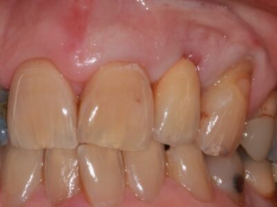 After - Brunswick Dental Practice