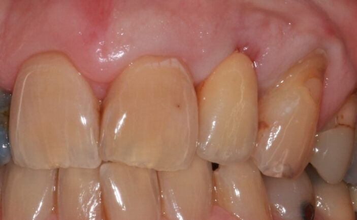 After - Brunswick Dental Practice