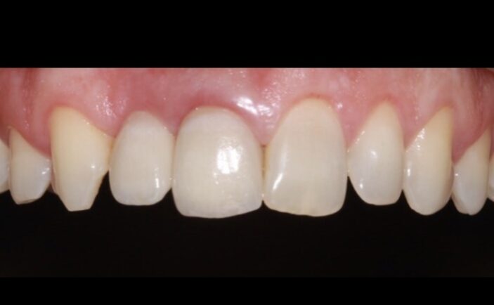 After - Brunswick Dental Practice