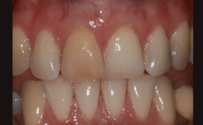 Before - Brunswick Dental Practice