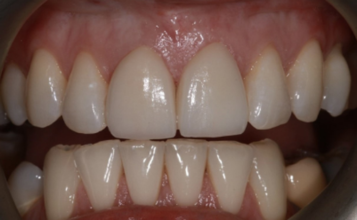 After - Brunswick Dental Practice