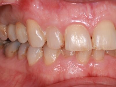 After - Brunswick Dental Practice