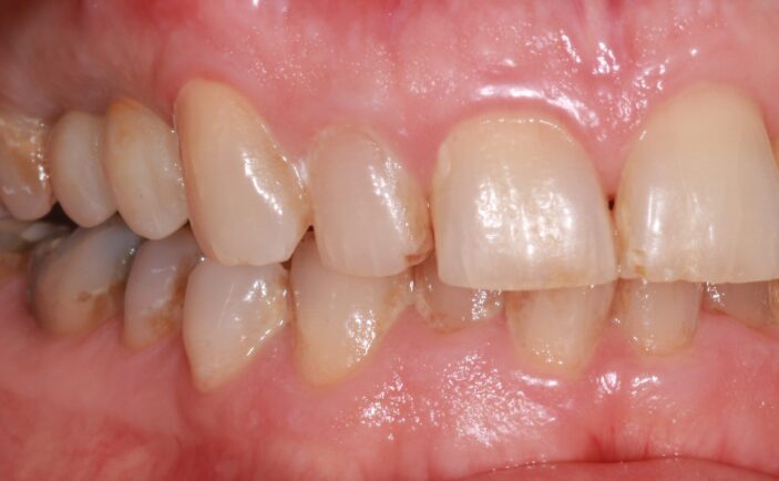 After - Brunswick Dental Practice