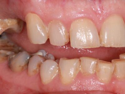 Before - Brunswick Dental Practice