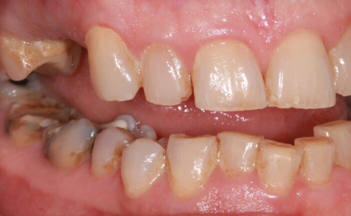 Before - Brunswick Dental Practice