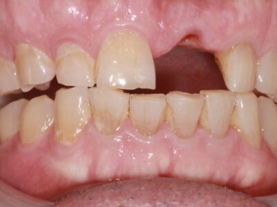 Before Face - Brunswick Dental Practice