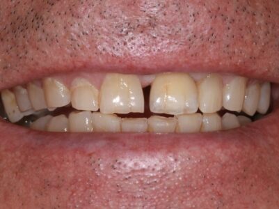 After - Brunswick Dental Practice