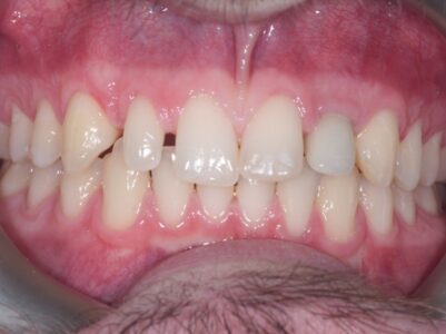 After - Brunswick Dental Practice