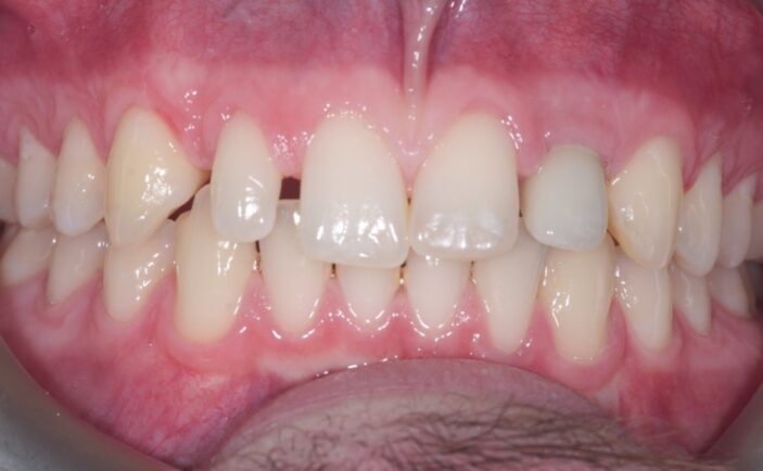 After - Brunswick Dental Practice