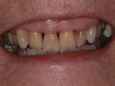 After - Brunswick Dental Practice