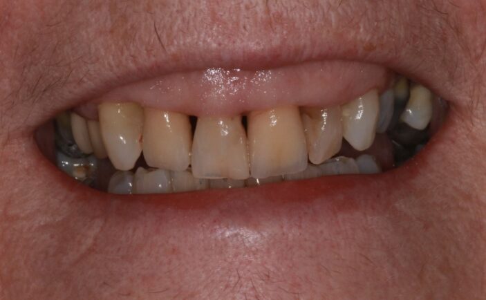 After - Brunswick Dental Practice