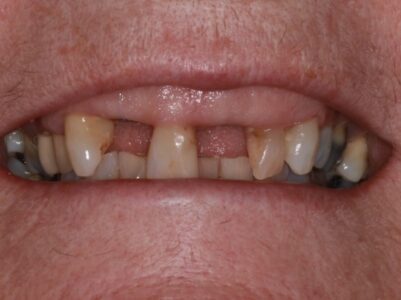 Before - Brunswick Dental Practice