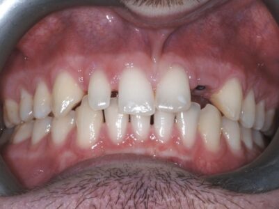 Before - Brunswick Dental Practice