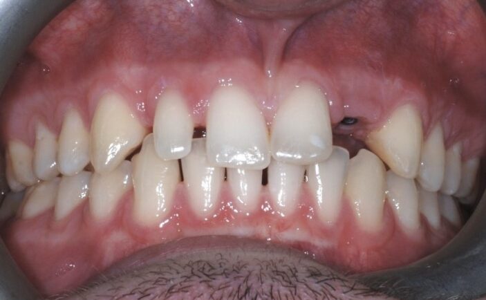 Before - Brunswick Dental Practice