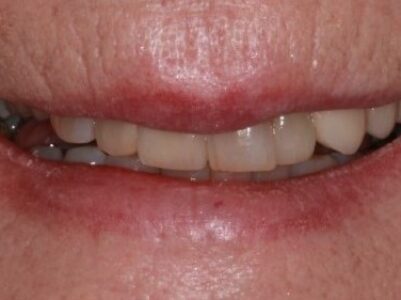 After - Brunswick Dental Practice