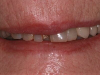 Before - Brunswick Dental Practice