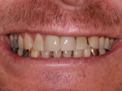 After - Brunswick Dental Practice