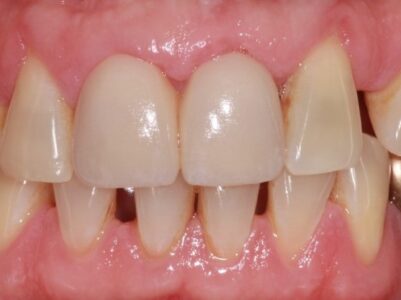 After - Brunswick Dental Practice