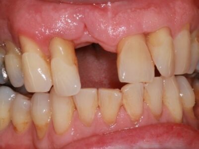 Before Face - Brunswick Dental Practice