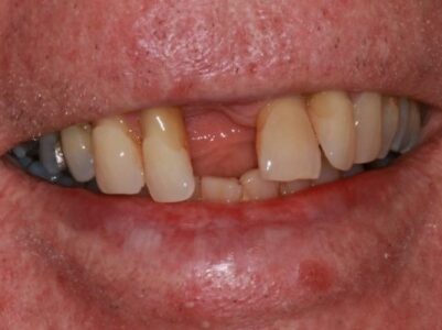 Before - Brunswick Dental Practice