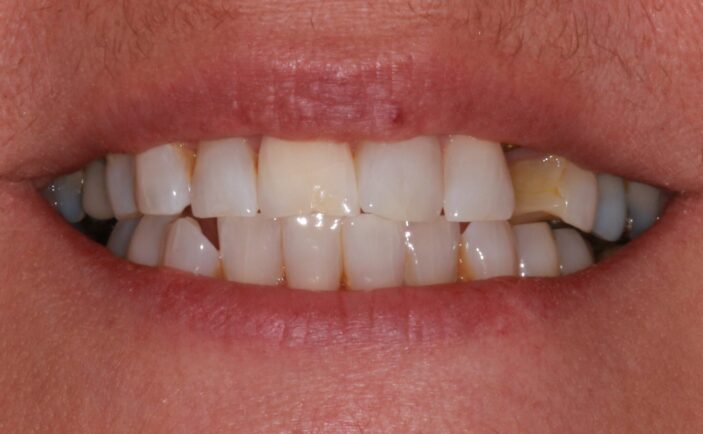 Before - Brunswick Dental Practice