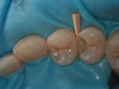 Before - Brunswick Dental Practice