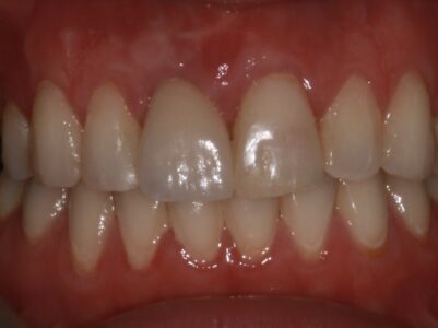 After - Brunswick Dental Practice