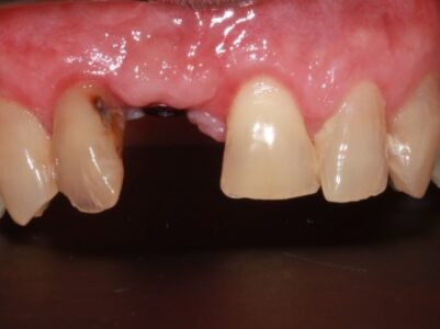 Before - Brunswick Dental Practice