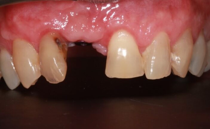 Before - Brunswick Dental Practice